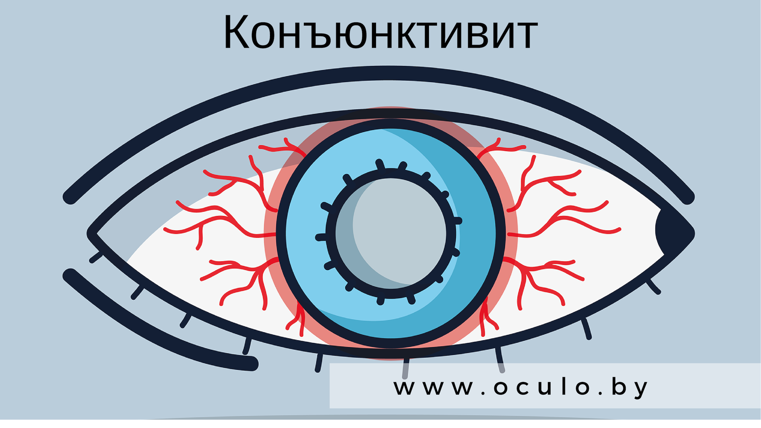 Конъюнктивит. Виды, симптомы и способы лечения