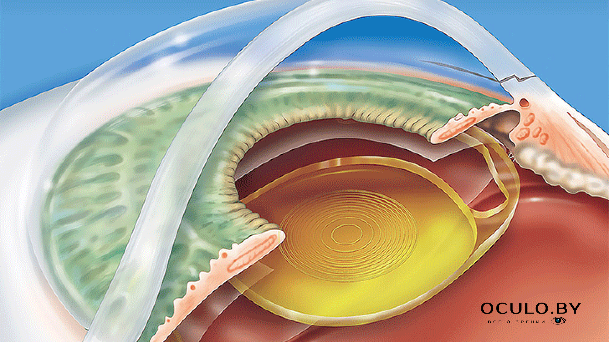 Хрусталик глаза анатомия. Искусственный хрусталик. Интраокулярная линза. Передняя капсула хрусталика.